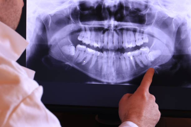 Best Chipped Tooth Repair Near Me  in Grayling, MI