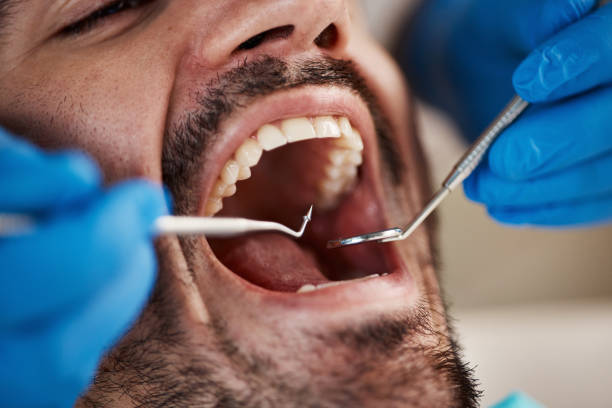 Best Tooth Infection Emergency Dentist  in Grayling, MI